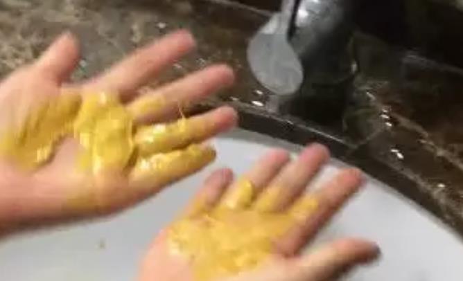 干透的美缝剂怎么清除